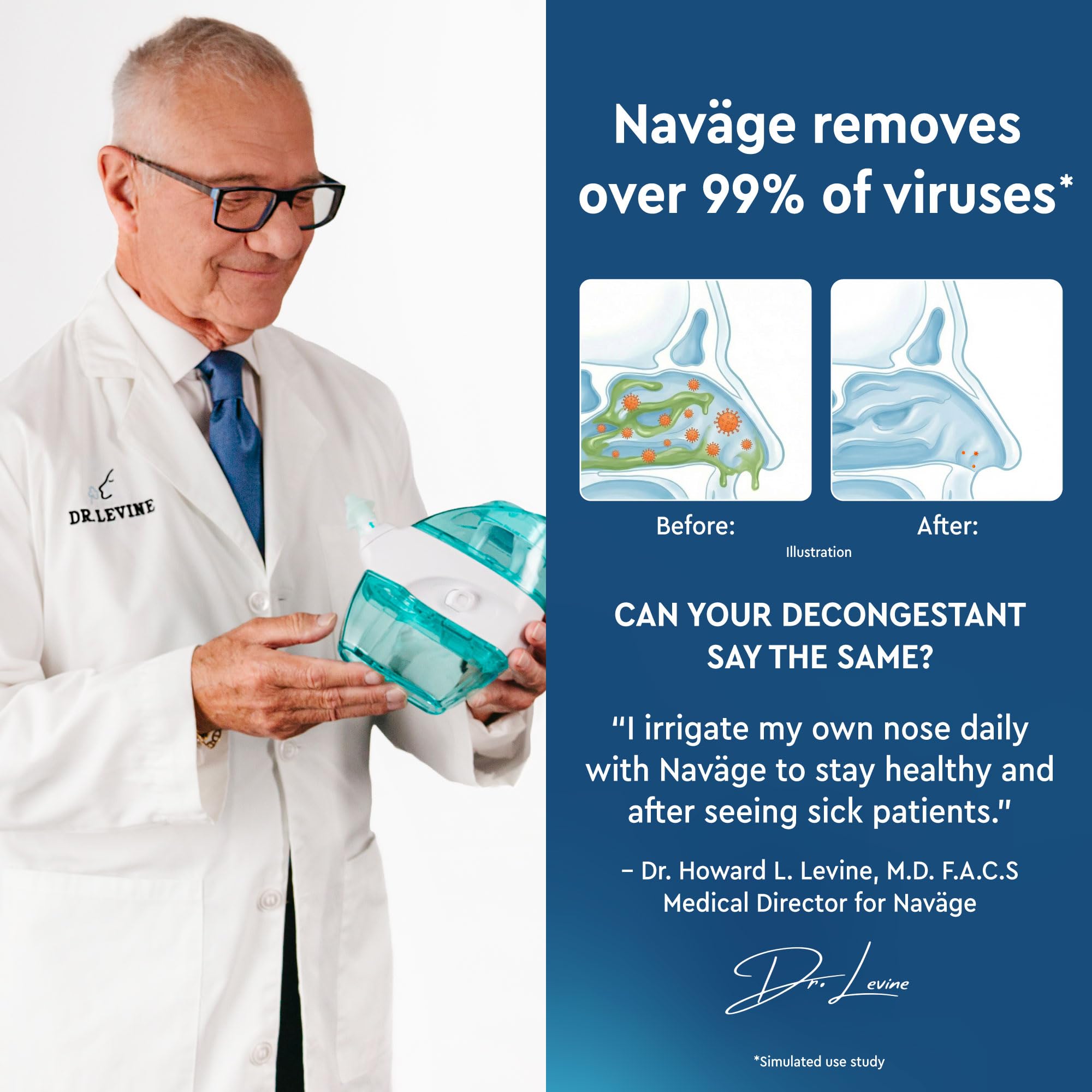 Navage® Starter Bundle – Nasal Irrigation System - Saline Nasal Rinse Kit with 1 Nose Cleaner and 20 SaltPods for Congestion Relief ($109 Value). Sinus Rinse for Clinically Proven Benefits Blue Starter U1